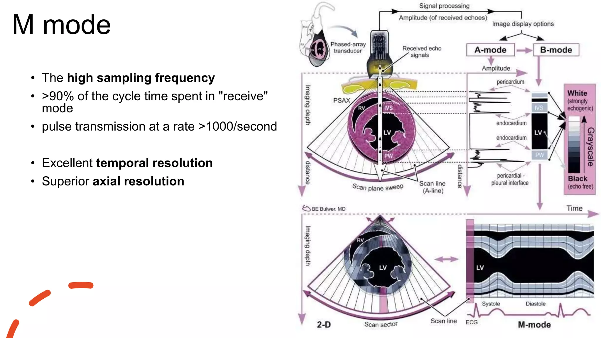 M mode
• The high sampling frequency
• >90% of the cycle time spent in "receive"
mode
• pulse transmission at a rate >1000/second
• Excellent temporal resolution
• Superior axial resolution
 