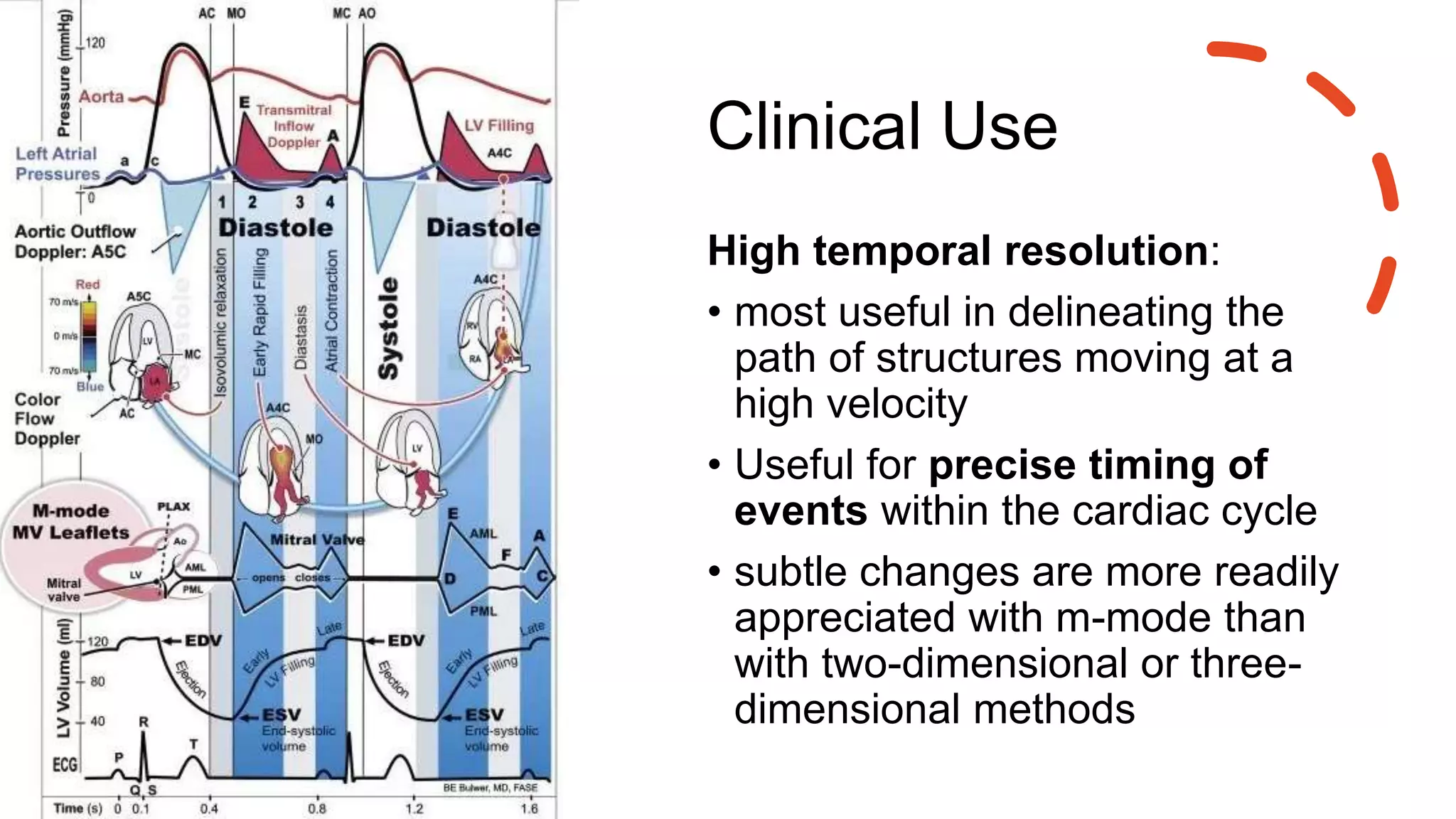 Clinical Use
High temporal resolution:
• most useful in delineating the
path of structures moving at a
high velocity
• Useful for precise timing of
events within the cardiac cycle
• subtle changes are more readily
appreciated with m-mode than
with two-dimensional or three-
dimensional methods
 