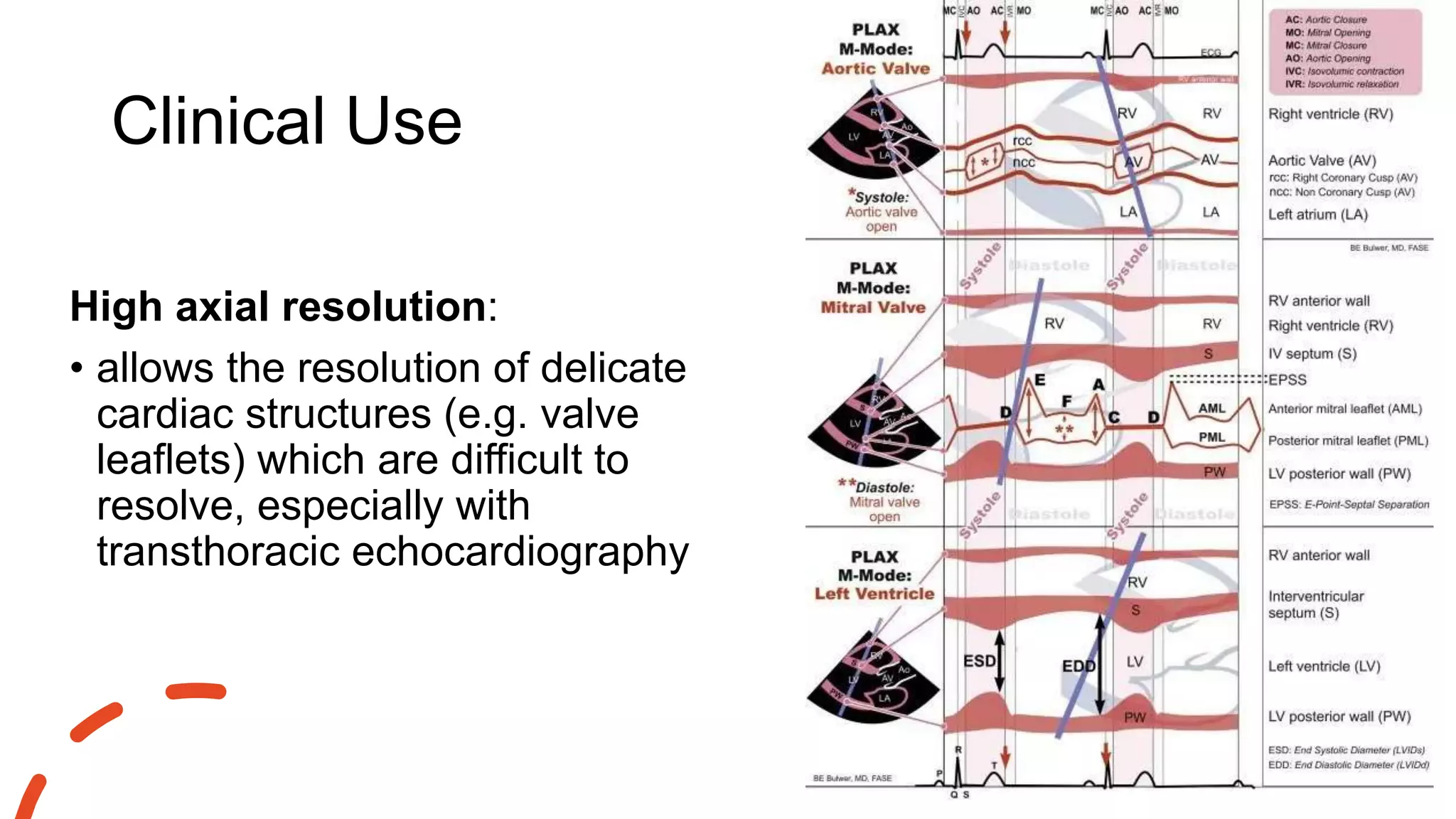 Clinical Use
High axial resolution:
• allows the resolution of delicate
cardiac structures (e.g. valve
leaflets) which are difficult to
resolve, especially with
transthoracic echocardiography
 