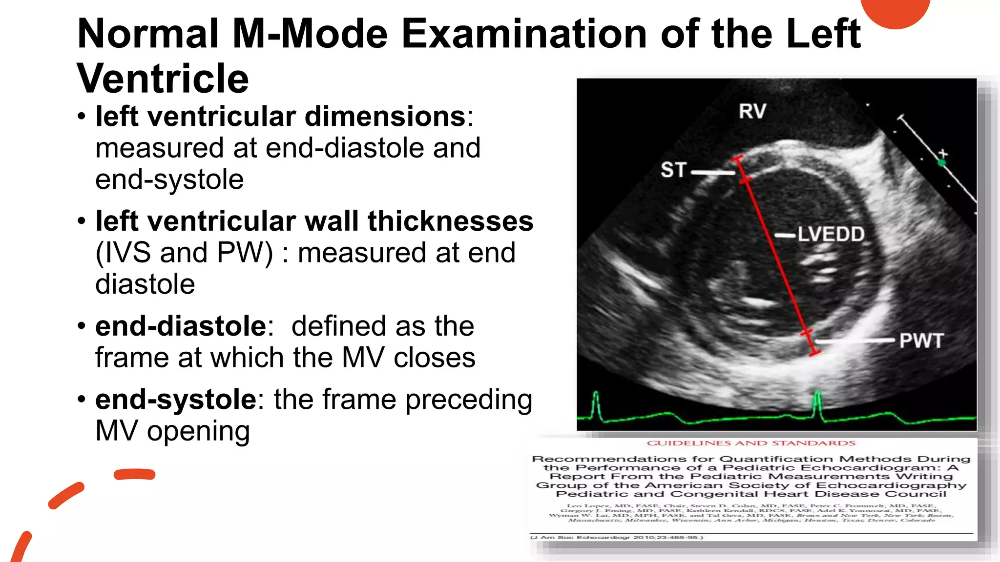 Normal M-Mode Examination of the Left
Ventricle
• left ventricular dimensions:
measured at end-diastole and
end-systole
• left ventricular wall thicknesses
(IVS and PW) : measured at end
diastole
• end-diastole: defined as the
frame at which the MV closes
• end-systole: the frame preceding
MV opening
 