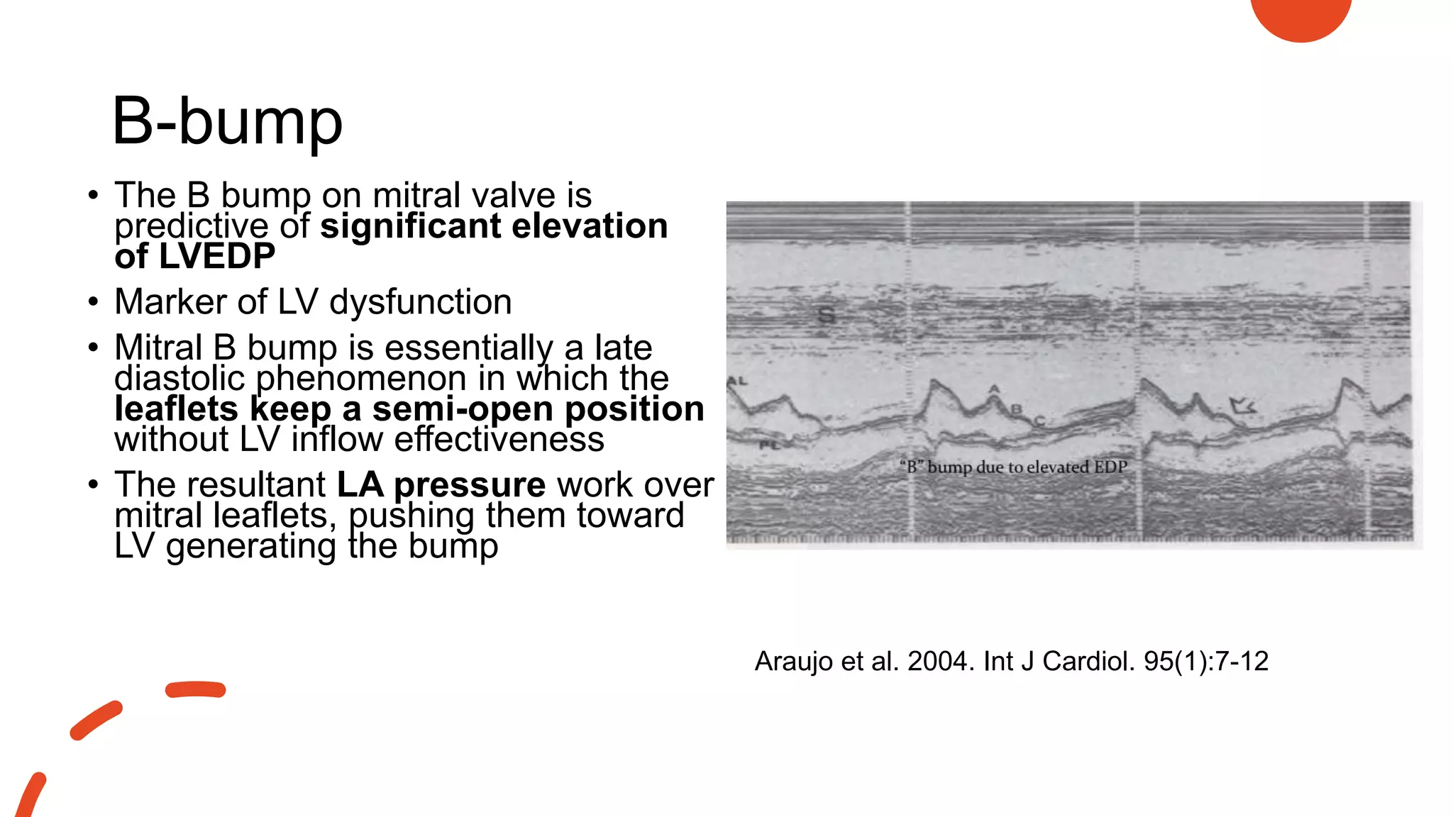 B-bump
• The B bump on mitral valve is
predictive of significant elevation
of LVEDP
• Marker of LV dysfunction
• Mitral B bump is essentially a late
diastolic phenomenon in which the
leaflets keep a semi-open position
without LV inflow effectiveness
• The resultant LA pressure work over
mitral leaflets, pushing them toward
LV generating the bump
Araujo et al. 2004. Int J Cardiol. 95(1):7-12
 