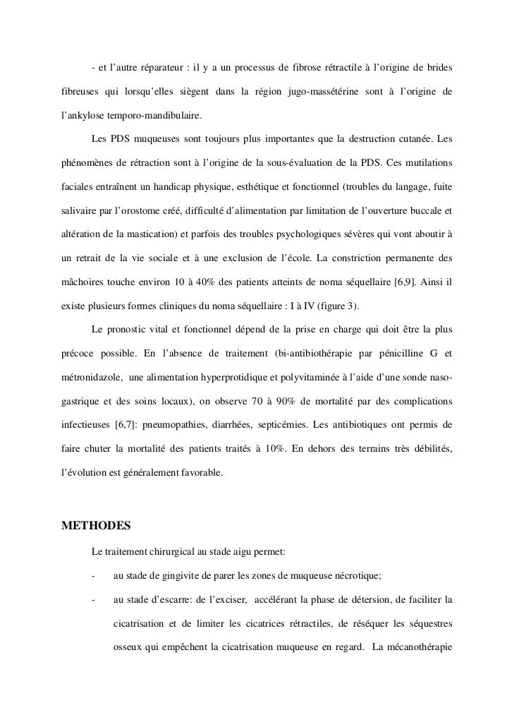 Thesis in oral surgery picture