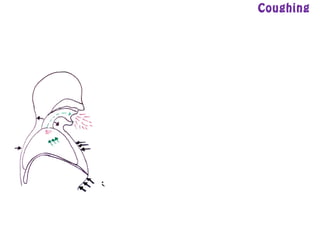 Coughing
 