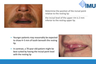 Determine the position of the incisal point
relative to the resting lip:
the incisal level of the upper rim is 2 mm
inferior to the resting upper lip.
 In contrast, a 70-year-old patient might be
best suited by having the incisal point level
with the resting lip
 Younger patients may reasonably be expected
to show 4–5 mm of tooth beneath the resting
lip.
 