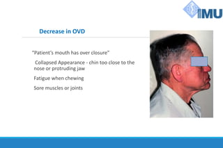 Decrease in OVD
“Patient’s mouth has over closure”
Collapsed Appearance - chin too close to the
nose or protruding jaw
Fatigue when chewing
Sore muscles or joints
 