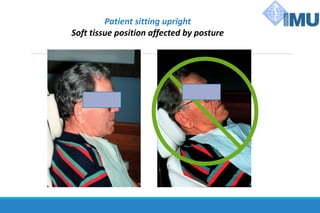 Patient sitting upright
Soft tissue position affected by posture
 