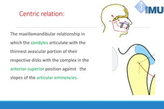 Centric relation:
The maxillomandibular relationship in
which the condyles articulate with the
thinnest avascular portion of their
respective disks with the complex in the
anterior-superior position against the
slopes of the articular eminencies.
 