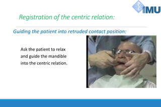 Registration of the centric relation:
Guiding the patient into retruded contact position:
Ask the patient to relax
and guide the mandible
into the centric relation.
 