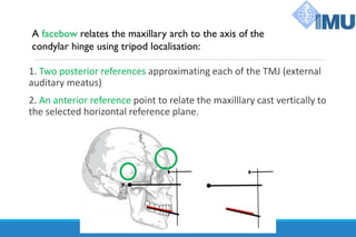 1. Two posterior references approximating each of the TMJ (external
auditary meatus)
2. An anterior reference point to relate the maxilllary cast vertically to
the selected horizontal reference plane.
A facebow relates the maxillary arch to the axis of the
condylar hinge using tripod localisation:
 