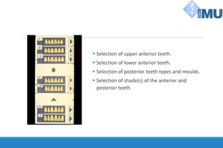 ▪ Selection of upper anterior teeth.
▪ Selection of lower anterior teeth.
▪ Selection of posterior teeth types and moulds.
▪ Selection of shade(s) of the anterior and
posterior teeth.
 