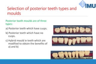 Selection of posterior teeth types and
moulds
Posterior tooth moulds are of three
types:
a) Posterior teeth which have cusps.
b) Posterior teeth which have no
cusps.
c) Hybrid mould ie teeth which are
modified to obtain the benefits of
a) and b)
 