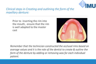 Clinical steps in Creating and outlining the form of the
maxillary denture:
Prior to inserting the rim into
the mouth, ensure that the rim
is well adapted to the master
cast
Remember that the technician constructed the occlusal rims based on
average values and it is the role of the dentist to create & outline the
form of the denture by adding or removing wax for each individual
patient.
 