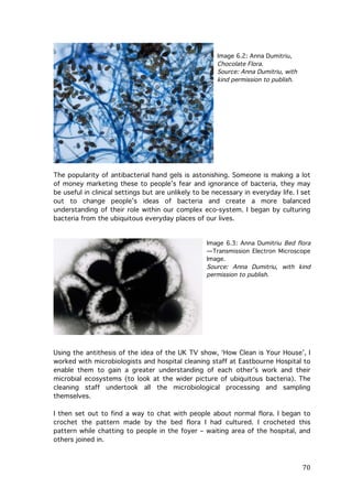 Image 6.2: Anna Dumitriu,
Chocolate Flora.
Source: Anna Dumitriu, with
kind permission to publish.

The popularity of antibacterial hand gels is astonishing. Someone is making a lot
of money marketing these to people’s fear and ignorance of bacteria, they may
be useful in clinical settings but are unlikely to be necessary in everyday life. I set
out to change people’s ideas of bacteria and create a more balanced
understanding of their role within our complex eco-system. I began by culturing
bacteria from the ubiquitous everyday places of our lives.

Image 6.3: Anna Dumitriu Bed flora
—Transmission Electron Microscope
Image.
Source: Anna Dumitriu, with kind
permission to publish.

Using the antithesis of the idea of the UK TV show, ‘How Clean is Your House’, I
worked with microbiologists and hospital cleaning staff at Eastbourne Hospital to
enable them to gain a greater understanding of each other’s work and their
microbial ecosystems (to look at the wider picture of ubiquitous bacteria). The
cleaning staff undertook all the microbiological processing and sampling
themselves.
I then set out to find a way to chat with people about normal flora. I began to
crochet the pattern made by the bed flora I had cultured. I crocheted this
pattern while chatting to people in the foyer – waiting area of the hospital, and
others joined in.

	
  

70	
  

 