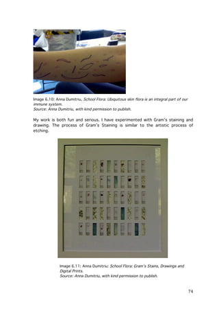 Image 6.10: Anna Dumitriu, School Flora: Ubiquitous skin flora is an integral part of our
immune system.
Source: Anna Dumitriu, with kind permission to publish.

My work is both fun and serious. I have experimented with Gram’s staining and
drawing. The process of Gram’s Staining is similar to the artistic process of
etching.

Image 6.11: Anna Dumitriu: School Flora: Gram’s Stains, Drawings and
Digital Prints.
Source: Anna Dumitriu, with kind permission to publish.

	
  

74	
  

 