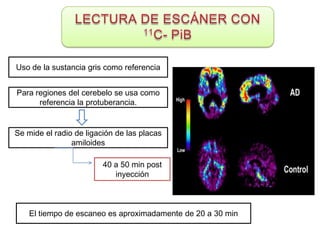 Uso de la sustancia gris como referencia


Para regiones del cerebelo se usa como
      referencia la protuberancia.


Se mide el radio de ligación de las placas
                amiloides

                         40 a 50 min post
                            inyección



    El tiempo de escaneo es aproximadamente de 20 a 30 min
 