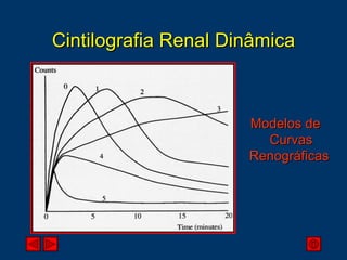 Cintilografia Renal Dinâmica Modelos de  Curvas Renográficas  