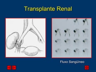 Transplante Renal Fluxo Sangüíneo 