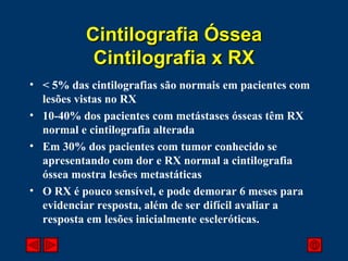 < 5% das cintilografias são normais em pacientes com lesões vistas no RX 10-40% dos pacientes com metástases ósseas têm RX normal e cintilografia alterada Em 30% dos pacientes com tumor conhecido se apresentando com dor e RX normal a cintilografia óssea mostra lesões metastáticas O RX é pouco sensível, e pode demorar 6 meses para evidenciar resposta, além de ser difícil avaliar a resposta em lesões inicialmente escleróticas. Cintilografia Óssea Cintilografia x RX 