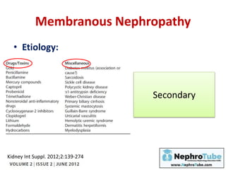 Membranous Nephropathy
• Etiology:
Secondary
Kidney Int Suppl. 2012;2:139-274
 