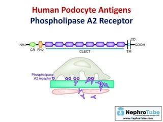 Human Podocyte Antigens
Phospholipase A2 Receptor
 