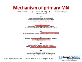 Mechanism of primary MN
Claudio Ponticelli, Richard J. Glassock. CJASN. 2014 Mar;9(3):609-16.
 