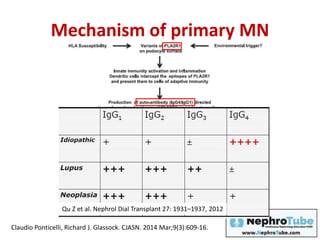 Mechanism of primary MN
Claudio Ponticelli, Richard J. Glassock. CJASN. 2014 Mar;9(3):609-16.
Qu Z et al. Nephrol Dial Transplant 27: 1931–1937, 2012
 