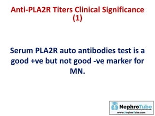 Serum PLA2R auto antibodies test is a
good +ve but not good -ve marker for
MN.
Anti-PLA2R Titers Clinical Significance
(1)
 
