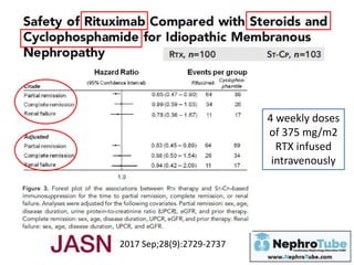 2017 Sep;28(9):2729-2737
4 weekly doses
of 375 mg/m2
RTX infused
intravenously
 