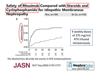 2017 Sep;28(9):2729-2737
The dashed lines describe the events in RTX-treated patients
4 weekly doses
of 375 mg/m2
RTX infused
intravenously
 