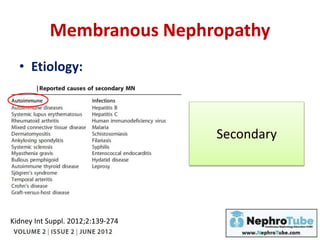 Membranous Nephropathy
• Etiology:
Secondary
Kidney Int Suppl. 2012;2:139-274
 