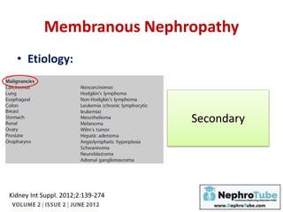 Membranous Nephropathy
• Etiology:
Secondary
Kidney Int Suppl. 2012;2:139-274
 
