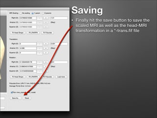 Saving
•

Finally hit the save button to save the
scaled MRI as well as the head-MRI
transformation in a *-trans.ﬁf ﬁle

 