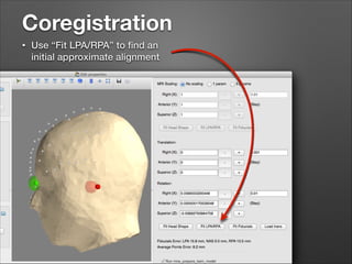 Coregistration
•

Use “Fit LPA/RPA” to ﬁnd an
initial approximate alignment

 