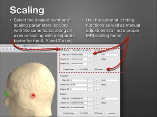 Scaling
•

Select the desired number of
scaling parameters (scaling
with the same factor along all
axes or scaling with a separate
factor for the X, Y and Z axes)

•

Use the automatic ﬁtting
functions as well as manual
adjustment to ﬁnd a proper
MRI scaling factor

 
