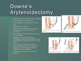management of b/l vocal cord paralysis | PPT