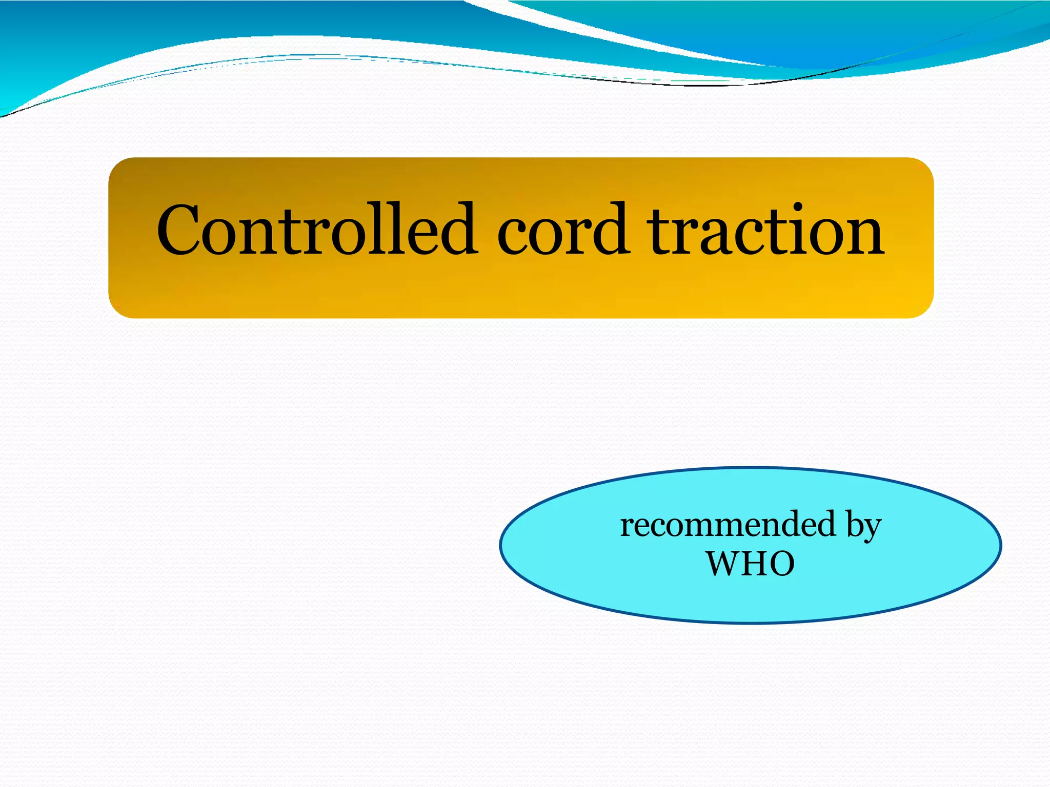 Controlled cord traction
recommended by
WHO
 