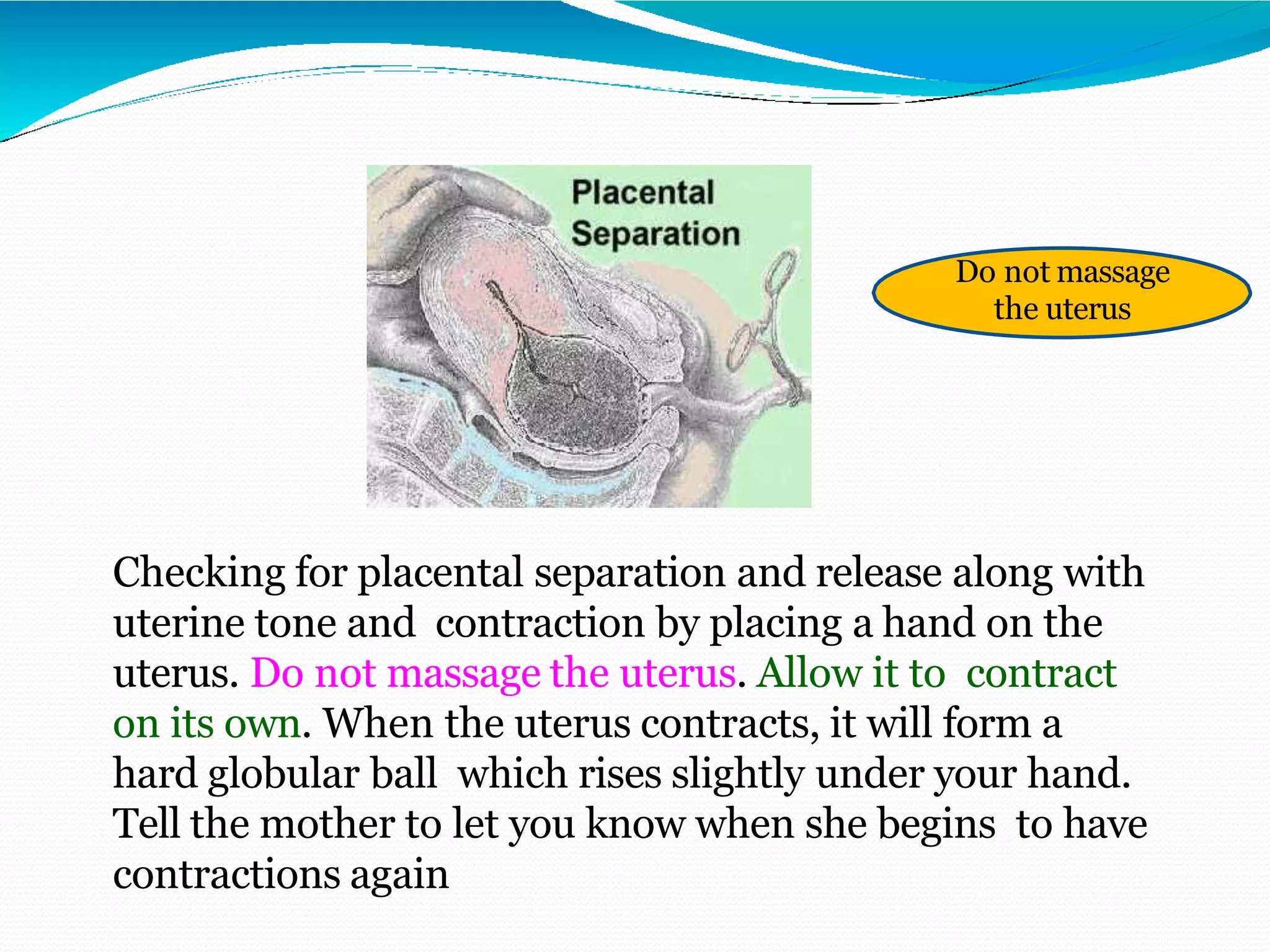 Checking for placental separation and release along with
uterine tone and contraction by placing a hand on the
uterus. Do not massage the uterus. Allow it to contract
on its own. When the uterus contracts, it will form a
hard globular ball which rises slightly under your hand.
Tell the mother to let you know when she begins to have
contractions again
Do not massage
the uterus
 