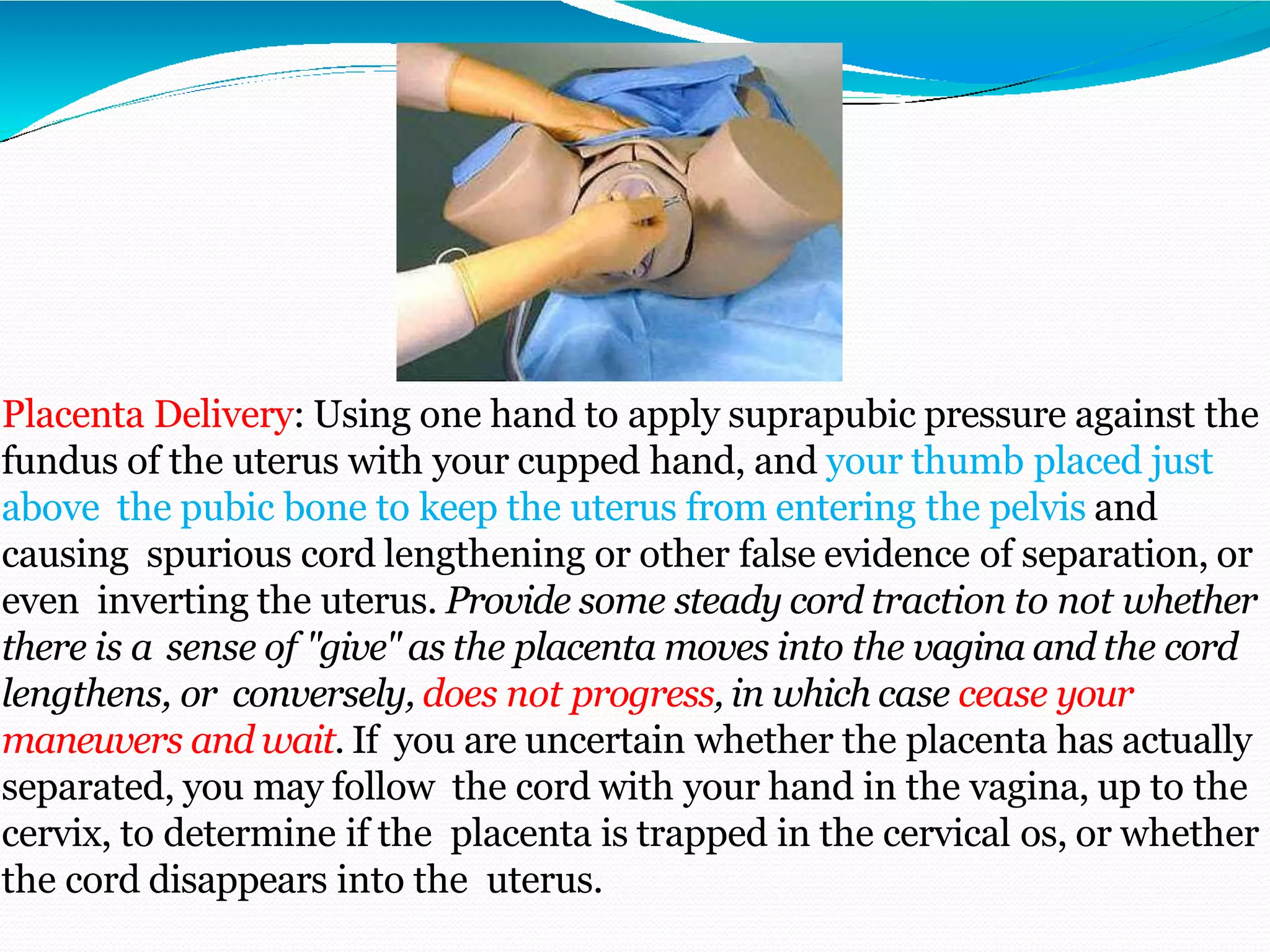 Placenta Delivery: Using one hand to apply suprapubic pressure against the
fundus of the uterus with your cupped hand, and your thumb placed just
above the pubic bone to keep the uterus from entering the pelvis and
causing spurious cord lengthening or other false evidence of separation, or
even inverting the uterus. Provide some steady cord traction to not whether
there is a sense of "give" as the placenta moves into the vagina and the cord
lengthens, or conversely, does not progress, in which case cease your
maneuvers and wait. If you are uncertain whether the placenta has actually
separated, you may follow the cord with your hand in the vagina, up to the
cervix, to determine if the placenta is trapped in the cervical os, or whether
the cord disappears into the uterus.
 