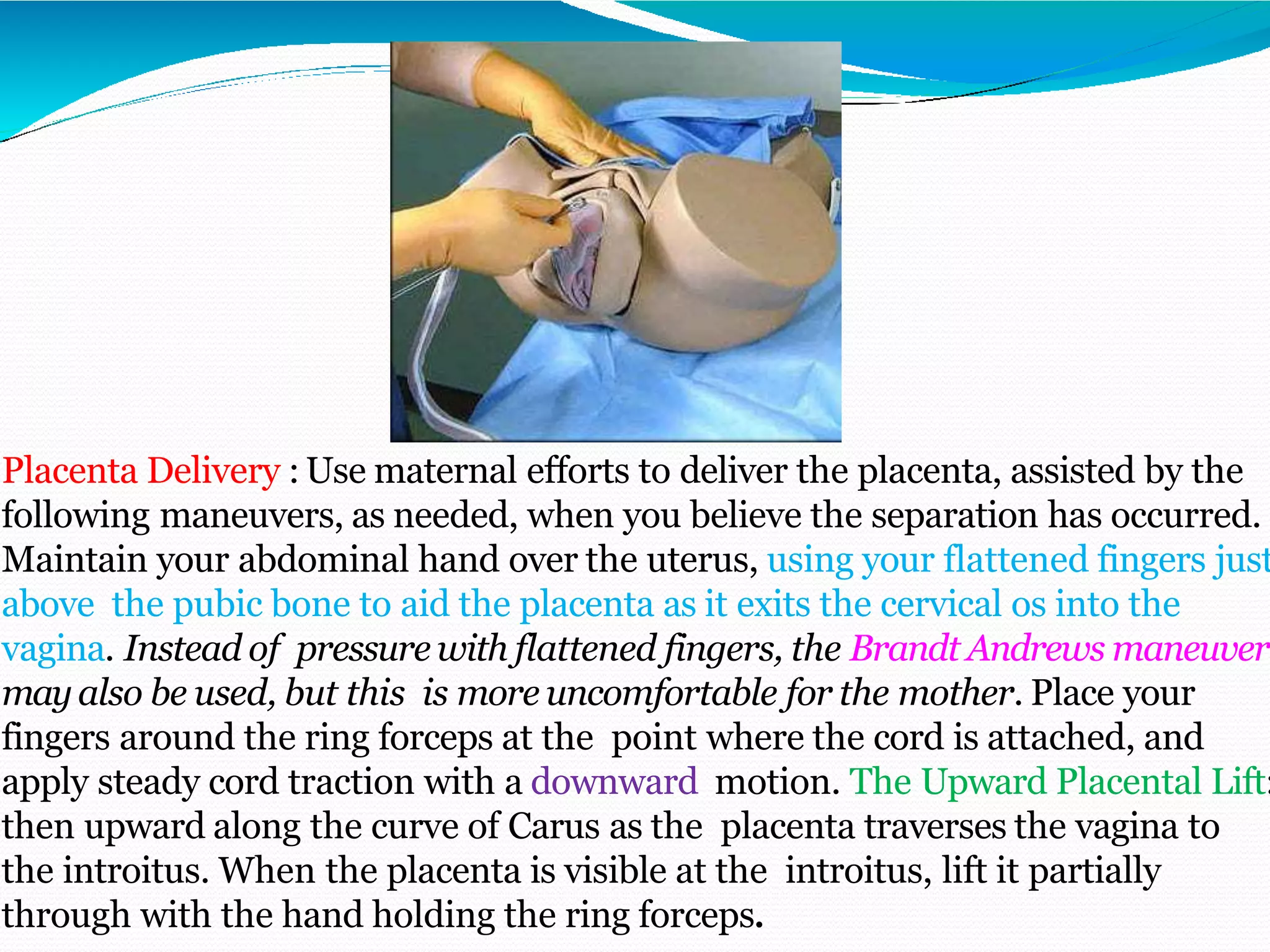 Placenta Delivery : Use maternal efforts to deliver the placenta, assisted by the
following maneuvers, as needed, when you believe the separation has occurred.
Maintain your abdominal hand over the uterus, using your flattened fingers just
above the pubic bone to aid the placenta as it exits the cervical os into the
vagina. Instead of pressure with flattened fingers, the Brandt Andrews maneuver
mayalso be used, but this is more uncomfortable for the mother. Place your
fingers around the ring forceps at the point where the cord is attached, and
apply steady cord traction with a downward motion. The Upward Placental Lift:
then upward along the curve of Carus as the placenta traverses the vagina to
the introitus. When the placenta is visible at the introitus, lift it partially
through with the hand holding the ring forceps.
 