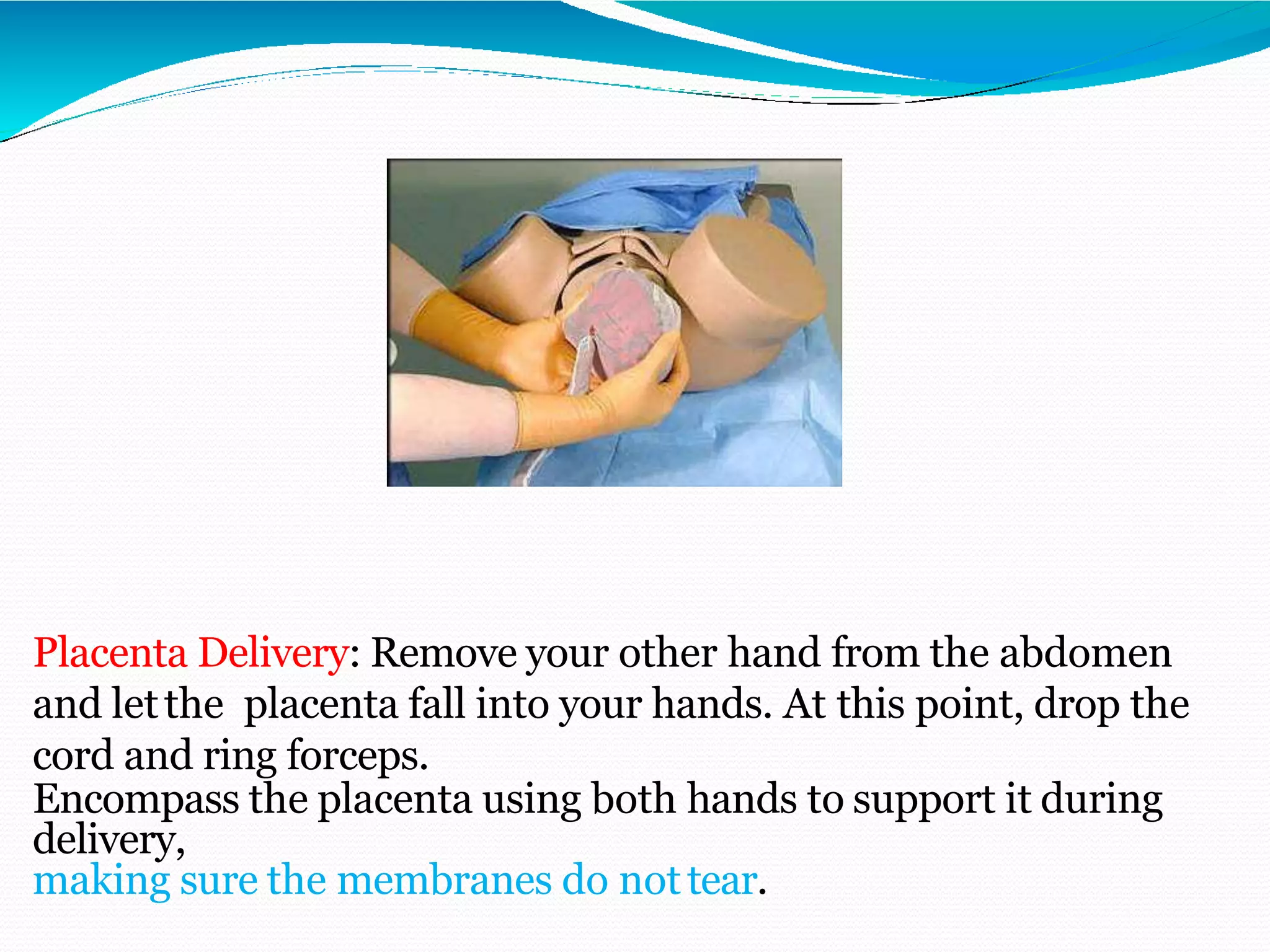Placenta Delivery: Remove your other hand from the abdomen
and letthe placenta fall into your hands. At this point, drop the
cord and ring forceps.
Encompass the placenta using both hands to support it during
delivery,
making sure the membranes do nottear.
 