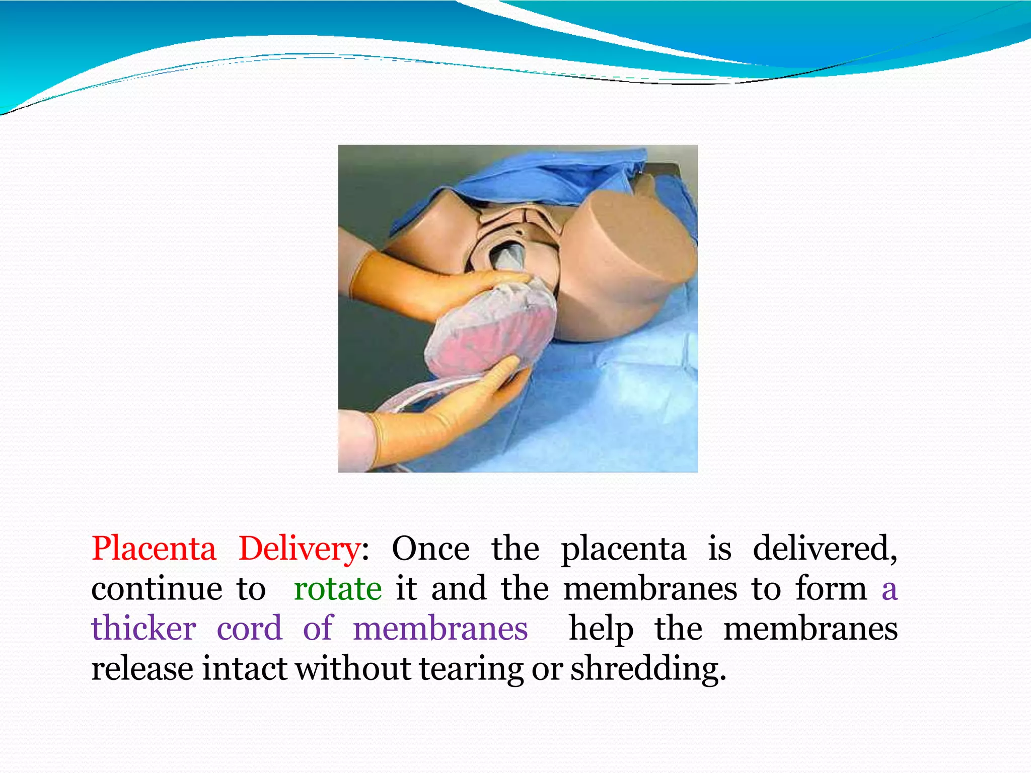 Placenta Delivery: Once the placenta is delivered,
continue to rotate it and the membranes to form a
thicker cord of membranes help the membranes
release intact without tearing or shredding.
 