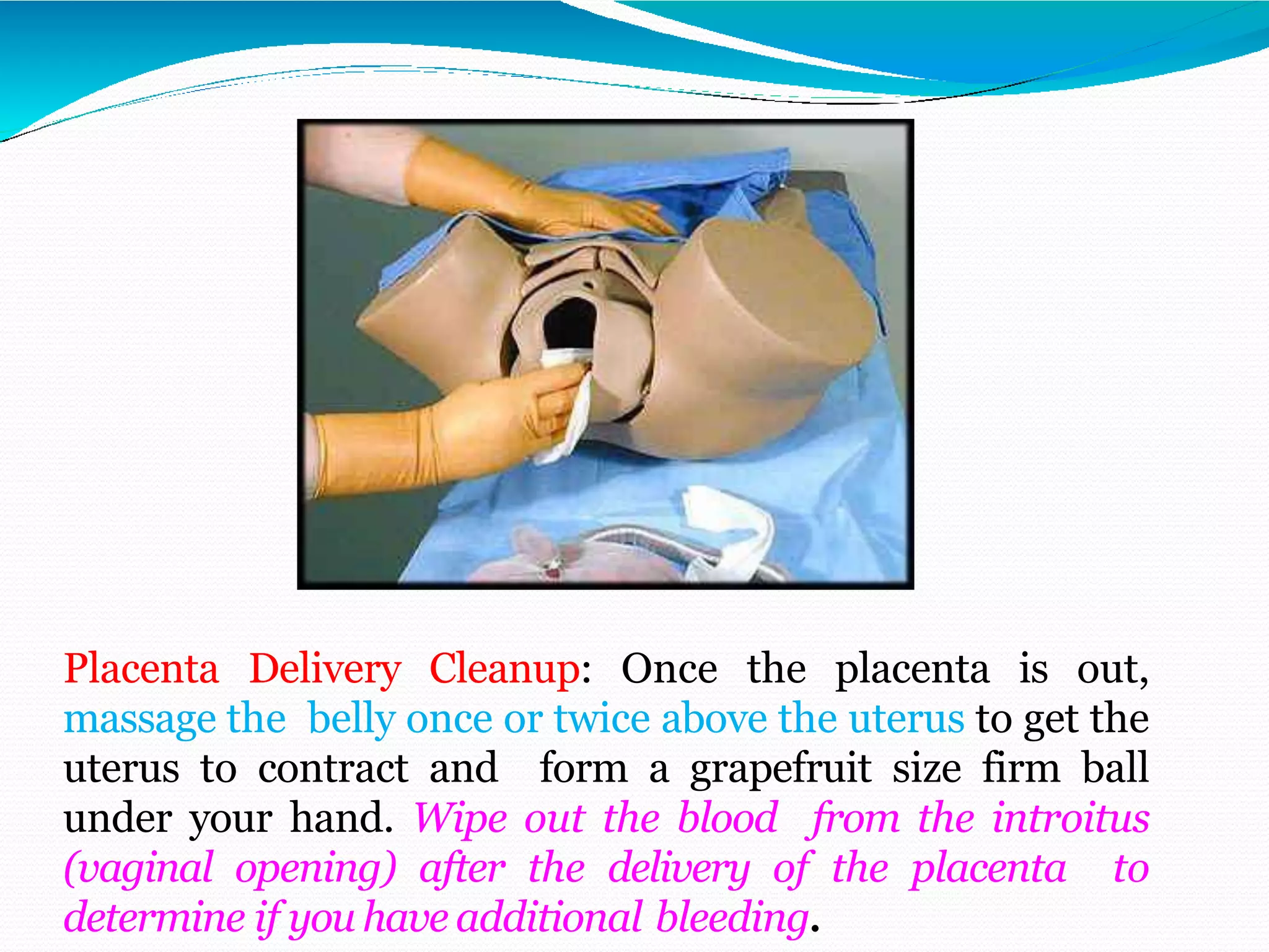 Placenta Delivery Cleanup: Once the placenta is out,
massage the belly once or twice above the uterus to get the
uterus to contract and form a grapefruit size firm ball
under your hand. Wipe out the blood from the introitus
(vaginal opening) after the delivery of the placenta to
determine if you have additional bleeding.
 
