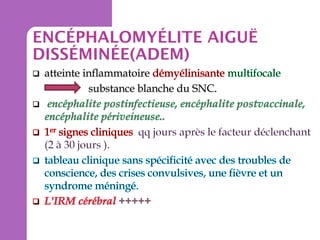 ENCÉPHALOMYÉLITE AIGUË
DISSÉMINÉE(ADEM)

 