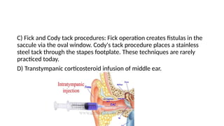 MÉNIÈRE’S DISEASE fhgfcbcbxvcfxfdxbgfhgfbv | PPTX