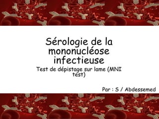 S/A
RSérologie de la
mononucléose
infectieuse
Test de dépistage sur lame (MNI
test)
Par : S / Abdessemed
 