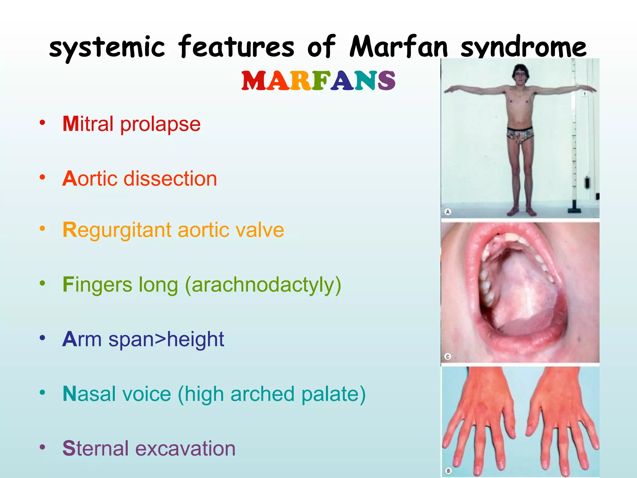 Mnemonics of Ophthalmology | PPT