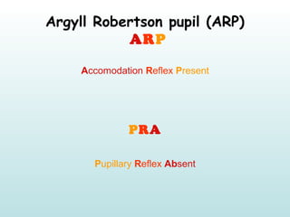 Argyll Robertson pupil (ARP)
ARP
Accomodation Reflex Present
PRA
Pupillary Reflex Absent
 