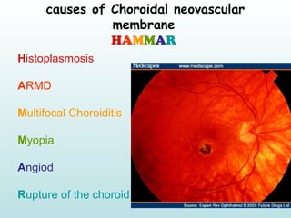 causes of Choroidal neovascular
membrane
HAMMAR
Histoplasmosis
ARMD
Multifocal Choroiditis
Myopia
Angiod
Rupture of the ch...
