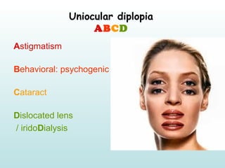 Uniocular diplopia
ABCD
Astigmatism
Behavioral: psychogenic
Cataract
Dislocated lens
/ iridoDialysis
 