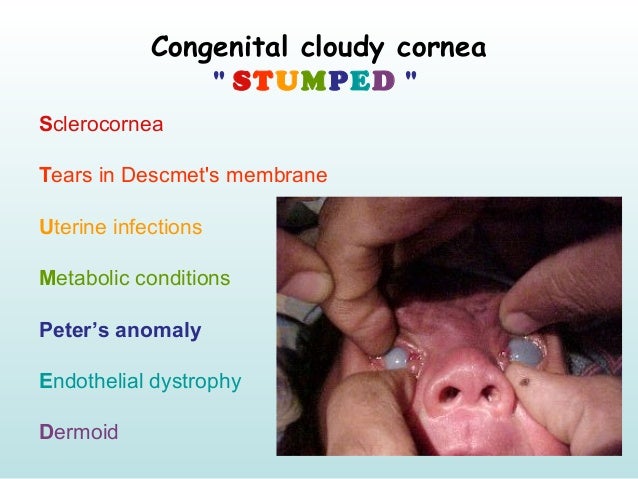 Stromal dystrophies marilyn monroe always gets her man in la city essay 02 picture